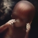 p7preg-24_1494409i