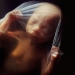 preg-38_1494419i