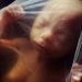 Amazing Photos of Developing Embryos