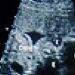Weeks 0-4 of Pregnancy