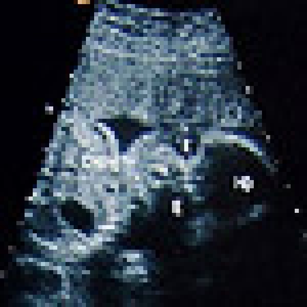 images of babies in the womb week by week. Weeks 0-4 of Pregnancy